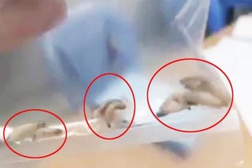 Gắp 40 con giòi trong tai người đàn ông