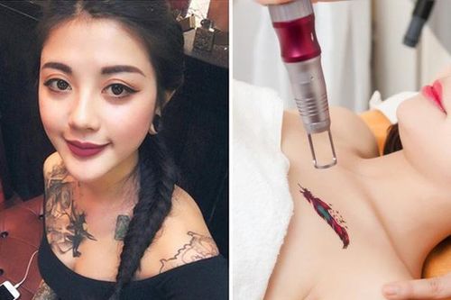Sự thật công nghệ xóa xăm không sẹo có hiệu quả như quảng cáo?