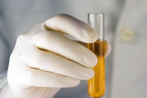 Ngủ dậy có 1 trong 4 triệu chứng này chứng tỏ gan không tốt, để lâu dễ thành ung thư
