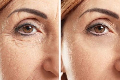 Bỏ ngay những thói quen này nếu không muốn nếp nhăn hình thành sớm