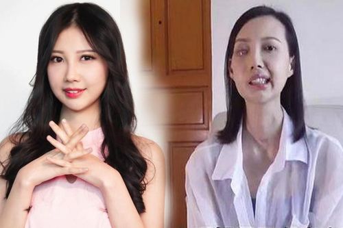 Xót xa với nữ ca sĩ bị ung thư, đăng video cầu mong sự giúp đỡ để được sống tiếp
