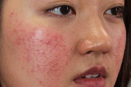 5 quy tắc sử dụng mỹ phẩm an toàn, không gây hại cho da