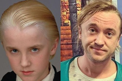 Ngoại hình xuống dốc của Tom Felton – chàng phù thủy Draco Malfoy phim 'Harry Potter'