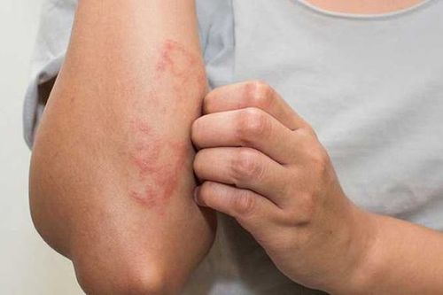 Cảnh giác với những nhóm bệnh thường gặp lúc giao mùa