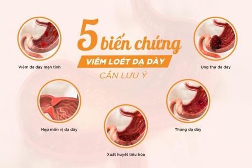 Sai lầm nghiêm trọng mà đa số người bệnh viêm loét dạ dày mạn tính hay gặp phải