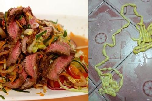 Hay ăn thịt bò tái, một người bị đau bụng và tự rút con sán dài hơn 5 mét từ người mình ra