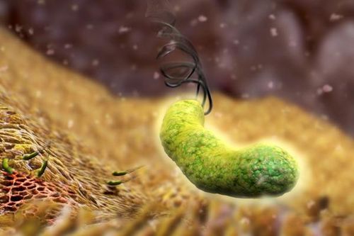 Diệt vi khuẩn H.Pylori: Loại bỏ một nguy cơ gây ung thư dạ dày