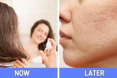 7 sai lầm khi chăm sóc da có thể khiến bạn bị mụn
