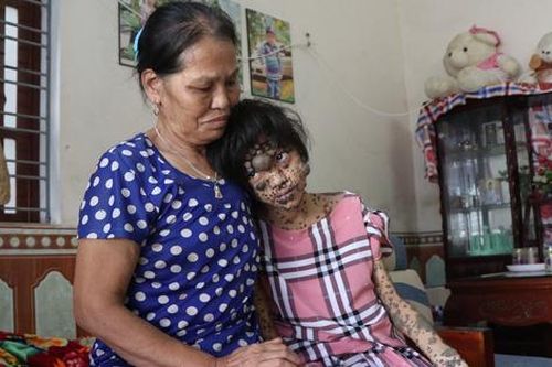 Mẹ chỉ ước cuộc sống bình thường cho đứa con mang 'thân hình của quỷ'