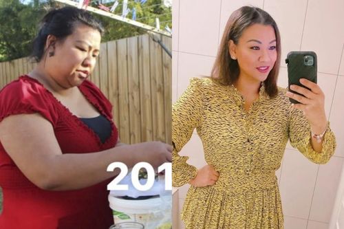 Người phụ nữ giảm 54 kg nhờ phẫu thuật cắt dạ dày