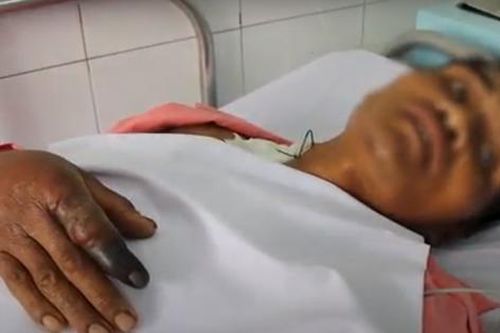 Người đàn ông thoát chết khi bị rắn hổ mang chúa dài 2,4m cắn