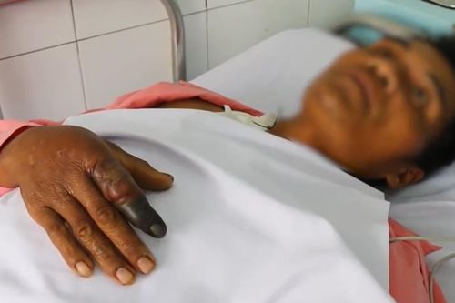 Cứu người đàn ông bị rắn hổ mang chúa dài hơn 2 mét cắn