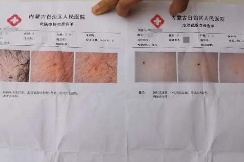 Giáo viên Trung Quốc bị tạm giam vì đâm kim vào người học sinh