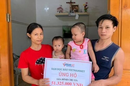 Bé Huyền Trang bị u não được bạn đọc ủng hộ hơn 51 triệu đồng