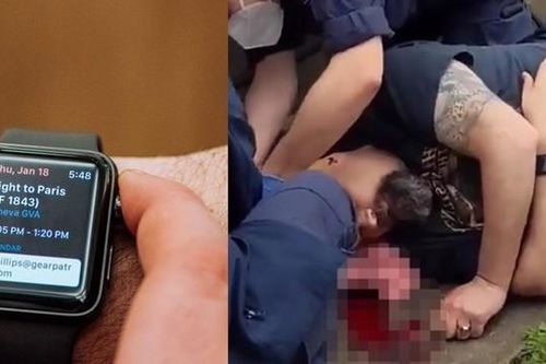 Đeo đồng hồ Apple Watch, chắc không ai nghĩ đến là có ngày nó sẽ cứu mạng mình