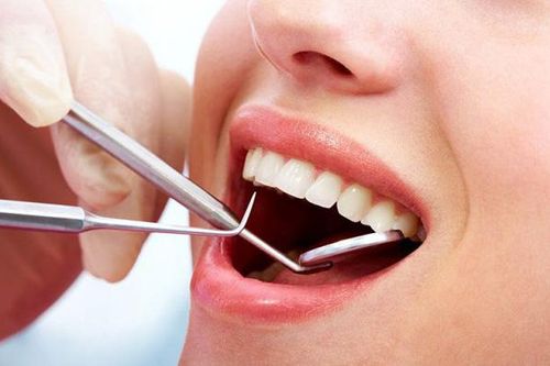 Lấy cao răng có ảnh hưởng đến sức khỏe không? Nên lấy cao răng mấy lần trong năm?