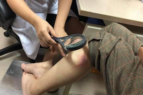 Hà Nội: Hai tuần, hàng nghìn người bị kiến ba khoang đốt phải đến viện