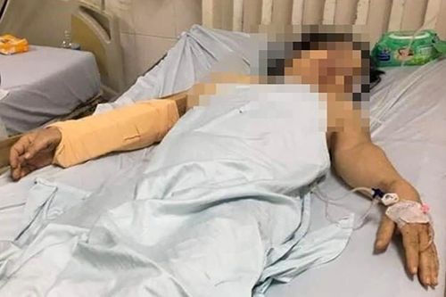 Người đàn ông cầm gậy đánh vợ cũ