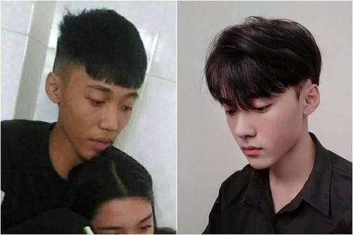 Gom tiền phẫu thuật thẩm mỹ, chàng trai 10X hóa 'hoàng tử bạch mã'