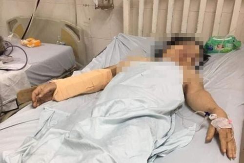 Kinh hoàng người cầm gậy đánh vợ cũ và cái kết đắng