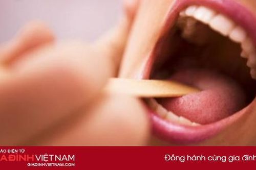 Những dấu hiệu trên lưỡi cảnh báo sức khỏe không bình thường