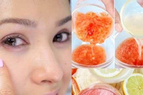Trẻ hơn 10 tuổi nhờ dùng hỗn hợp rẻ tiền này đánh bay quầng thâm, bọng mắt