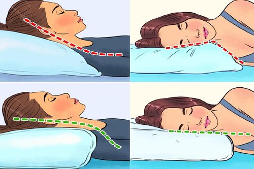 Chọn gối ngủ sai, sức khỏe của bạn ảnh hưởng thế nào?