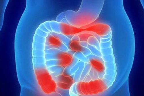 3 thứ 'hung thần' khiến dạ dày, đường ruột sợ hãi nhất: Bạn có đang làm hàng ngày không?