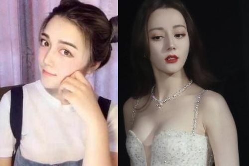 Mặt trái về phẫu thuật thẩm mỹ ở showbiz Trung Quốc