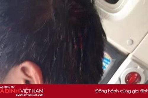 Nhân viên nhà xe Đoàn Liên - Nam Định bị đánh nhập viện