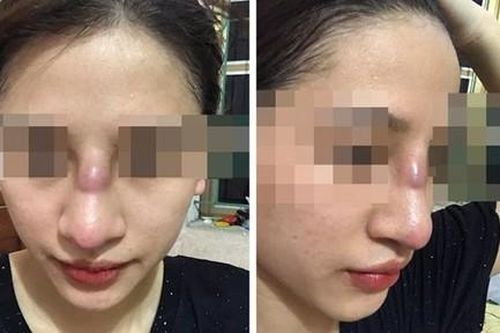 Coi chừng rước họa từ phẫu thuật thẩm mỹ