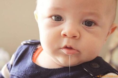 Xử trí kích ứng da do chảy dãi ở trẻ nhỏ