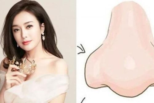 Trên mặt xuất hiện 4 dấu hiệu này: Chủ nhân cần thận trọng