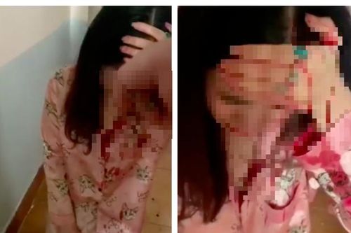 Clip 'tiểu tam' bị vợ nhân tình đánh ghen chảy máu đầu, quỳ gối van xin tha thứ khiến cư dân mạng tranh cãi dữ dội