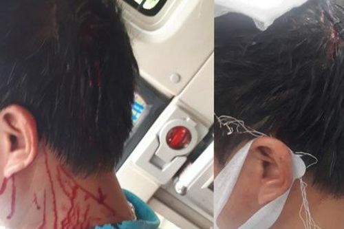 Công an lấy lời khai nhóm đối tượng cầm tuýp sắt đánh phụ xe khách gục giữa đường ở Hà Nội