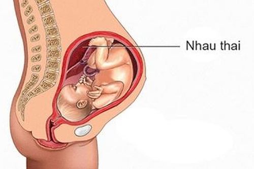 Các chất gây ô nhiễm không khí có thể tiếp cận đến nhau thai