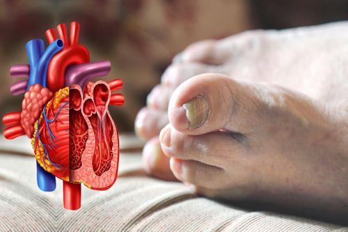 Tay, chân lạnh cảnh báo sức khỏe gặp vấn đề gì?