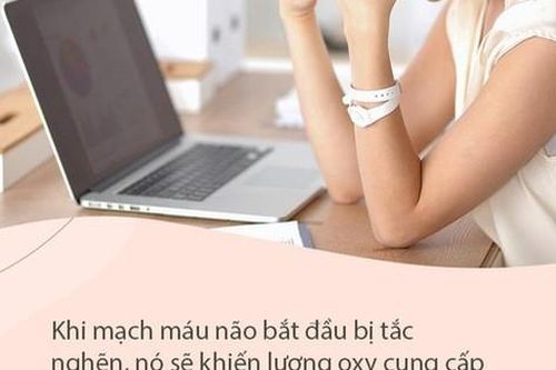 Nếu xuất hiện 4 dấu hiệu này trên mặt, cẩn thận 'kẻ giết người đột ngột' mang tên nhồi máu não sắp xảy ra