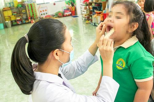 Những lưu ý chăm sóc răng cho trẻ dưới 3 tuổi