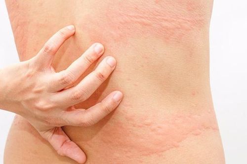 Phòng ngừa 3 bệnh về da mùa thu