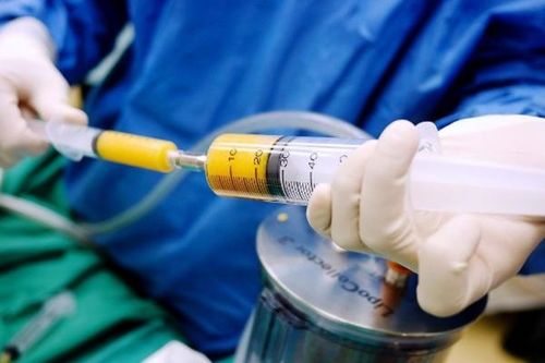 Kỹ thuật ghép tế bào mỡ tự thân