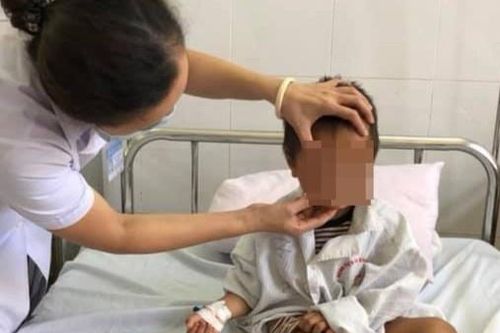 Dập mi vì bị dây thun bắn vào mắt