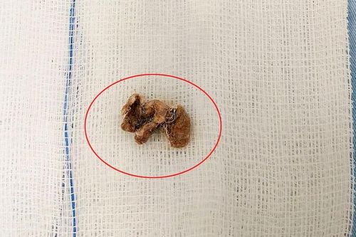 Bé gái nhét dị vật trong 'vùng kín': Dạy trẻ tránh tái phạm
