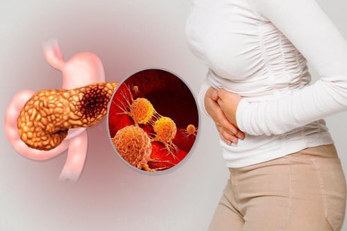 Dấu hiệu nhận biết bệnh ung thư tuyến tụy