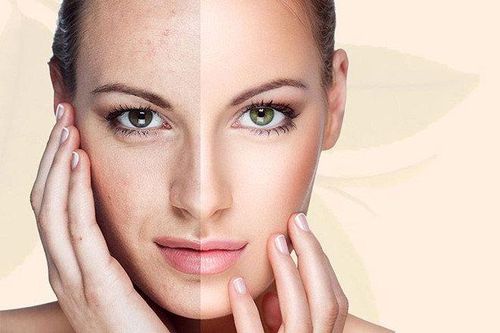 Những lý do giúp bạn nhận ra loại mỹ phẩm bạn đang sử dụng là 1 lựa chọn sai lầm