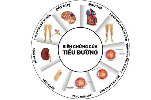 Đái tháo đường không phải là 'bệnh nhà giàu'