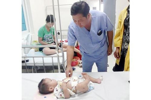 Mổ cứu sống thành công bé gái 10 tháng tuổi có nang ống mật chủ cực lớn