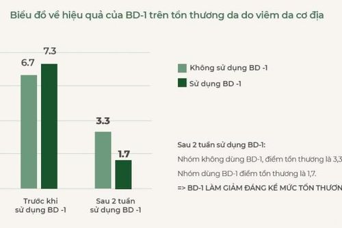 Bước đột phá trong hỗ trợ điều trị viêm da cơ địa