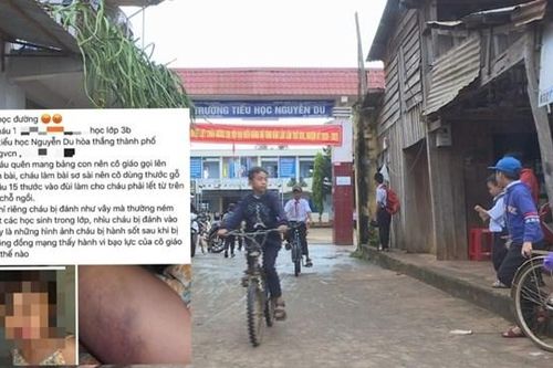Vụ 'cô giáo đánh tím đùi học sinh': Đề nghị kỉ luật bằng hình thức khiển trách