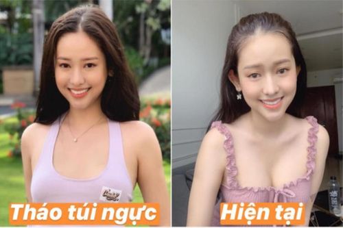 Hot girl Cà Mau và những lần 'bật tắt' vòng 1 gây chú ý